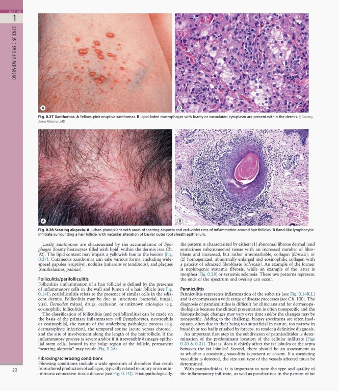 بیماری‌های پوست سه جلدی 2025 | Dermatology Bolognia 5th Edition