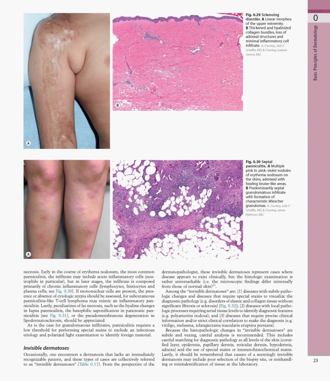 بیماری‌های پوست سه جلدی 2025 | Dermatology Bolognia 5th Edition