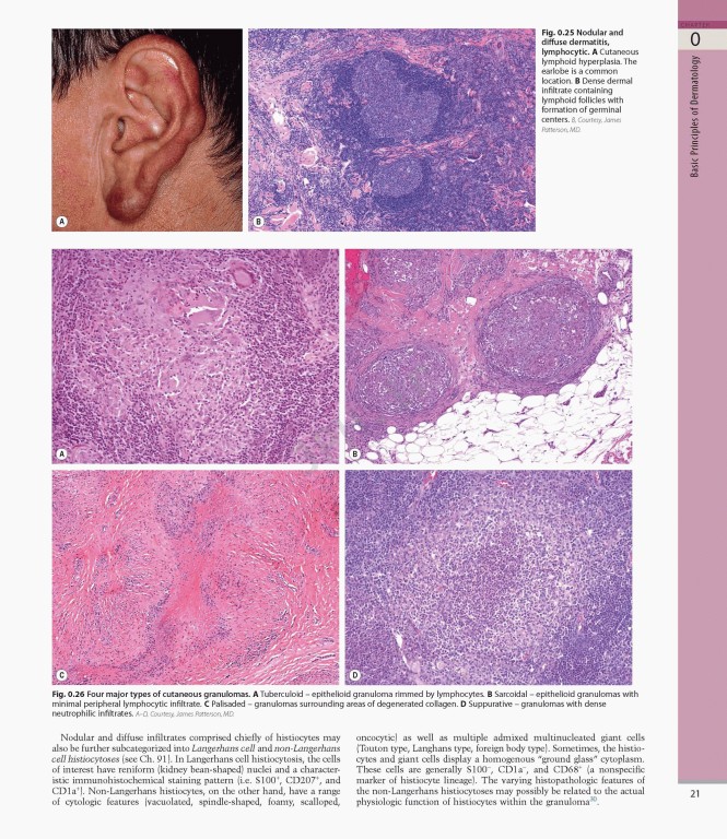 بیماری‌های پوست سه جلدی 2025 | Dermatology Bolognia 5th Edition