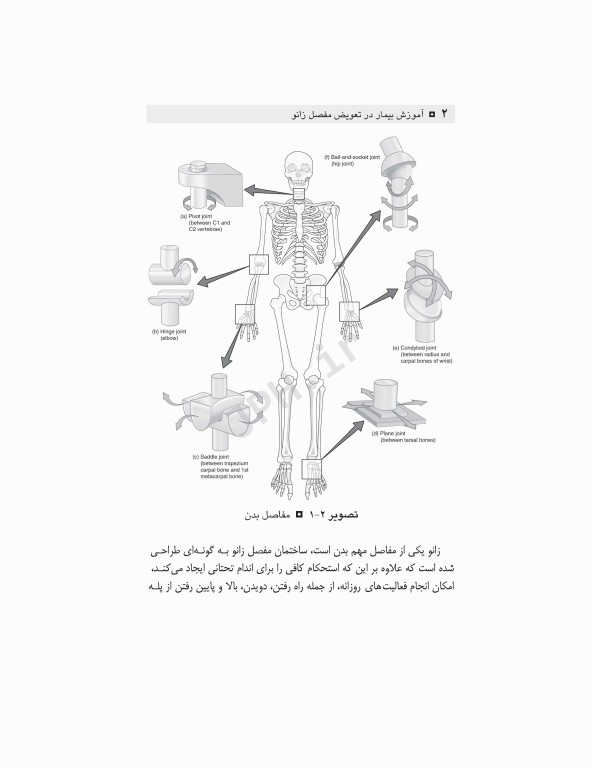 آموزش به بیمار و خانواده تعویض مفصل زانو