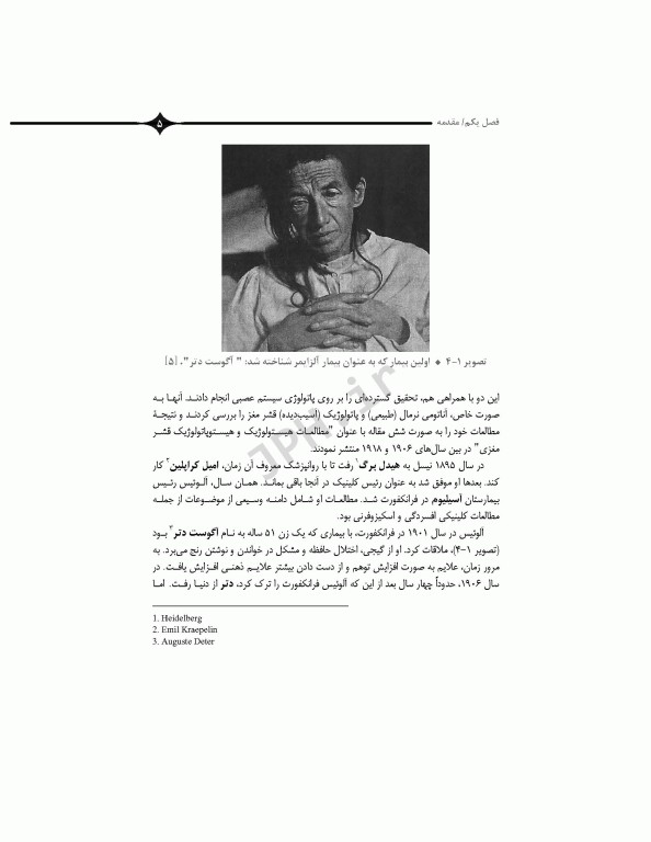 همه چیز در مورد بیماری آلزایمر