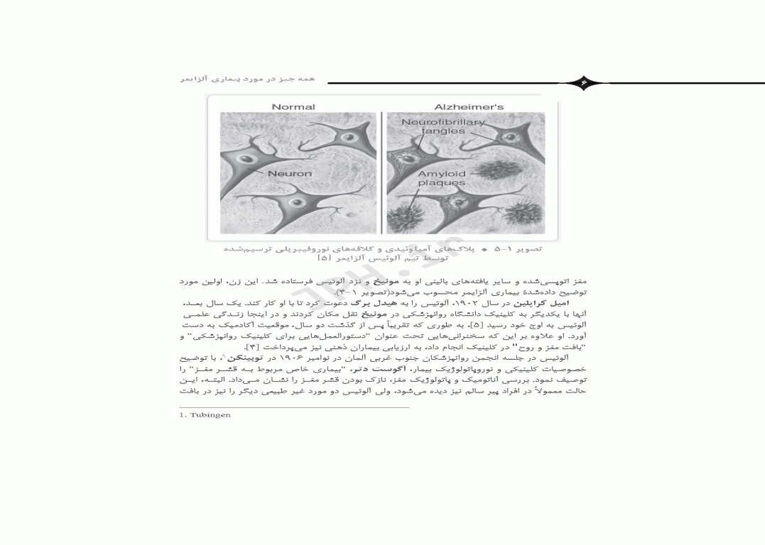 همه چیز در مورد بیماری آلزایمر