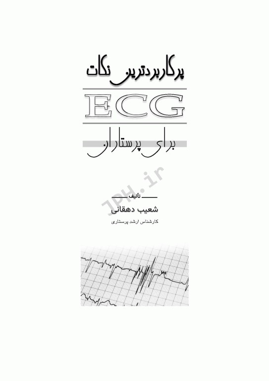 پرکاربردترین نکات ECG برای پرستاران