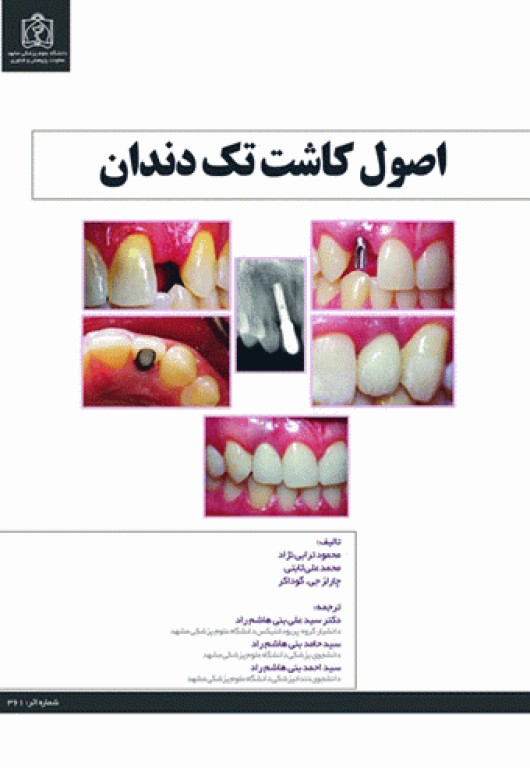 اصول کاشت تک دندان دکتر ترابی‌نژاد 2014