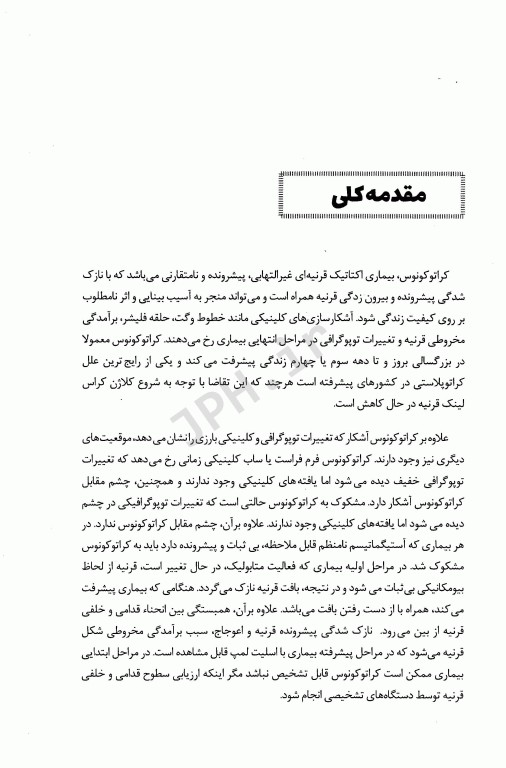 کراتوکونوس شیوع علت تشخیص و روش‌های درمان