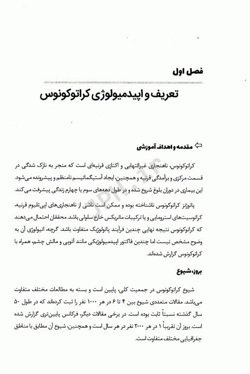 کراتوکونوس شیوع علت تشخیص و روش‌های درمان