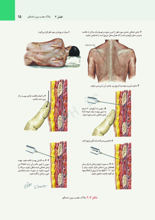 مقدمه‌ای بر اقدامات بالینی نتر + CD