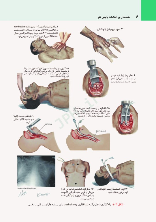 مقدمه‌ای بر اقدامات بالینی نتر + CD