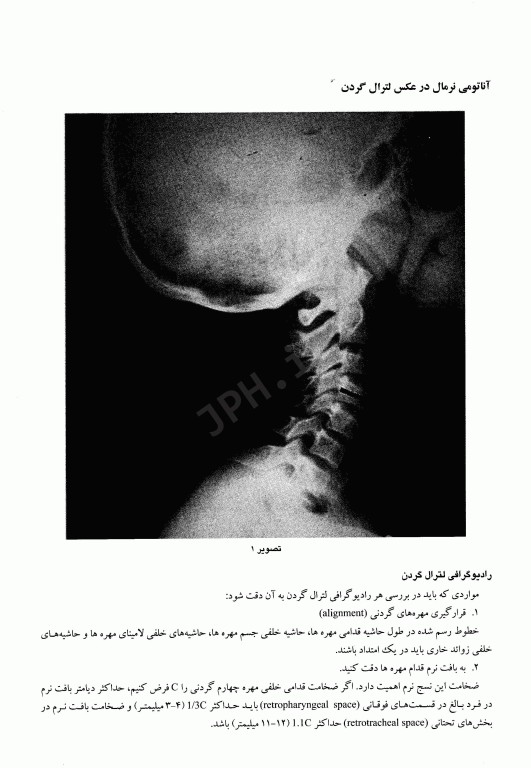 نمایش تصویری بیماری‌های لوله گوارش فوقانی