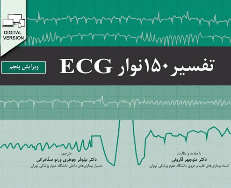 تفسیر 150 نوار ECG دکتر منوچهر قارونی