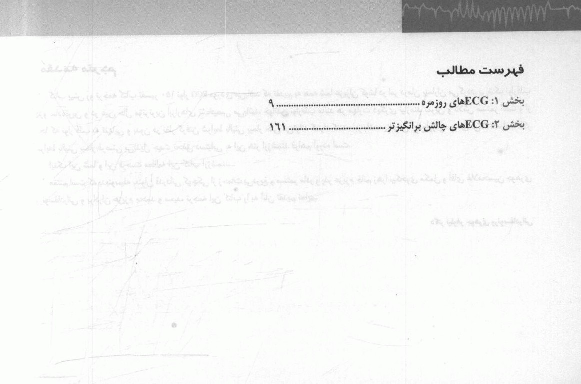 تفسیر 150 نوار ECG دکتر منوچهر قارونی