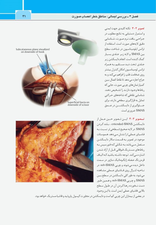 نواحی خطر صورت در پروسیجرهای زیبایی دکتر داوود رمزی