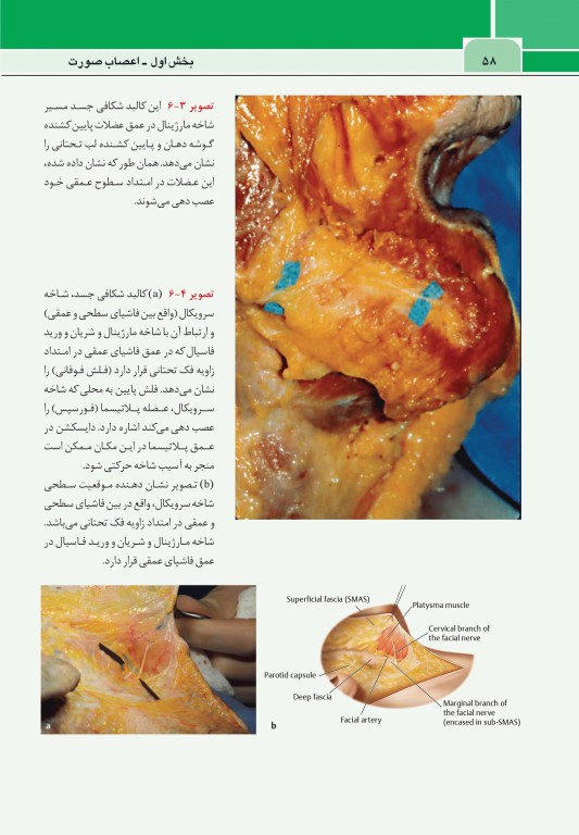 نواحی خطر صورت در پروسیجرهای زیبایی دکتر داوود رمزی
