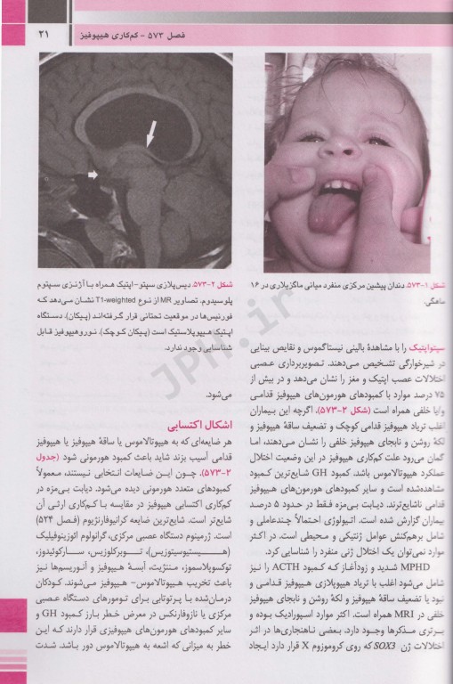 مبانی طب کودکان نلسون 2020 بیماری‌های غدد