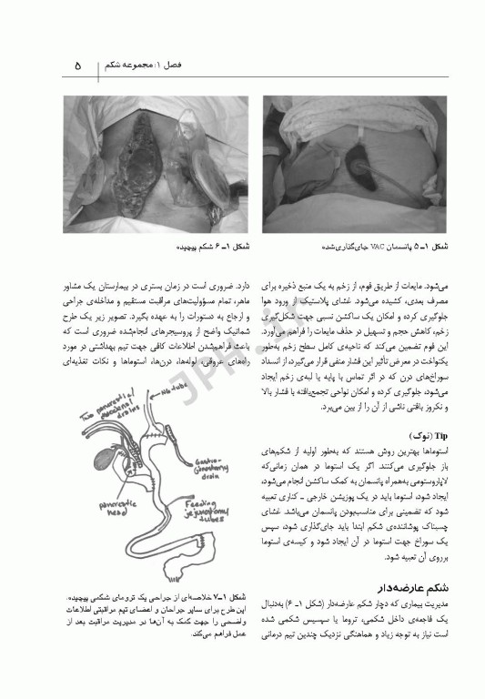 الفبای لوله‌ها‏‏، درن‌ها راه‌های عروقی و قالب‌ها آدام برکلز