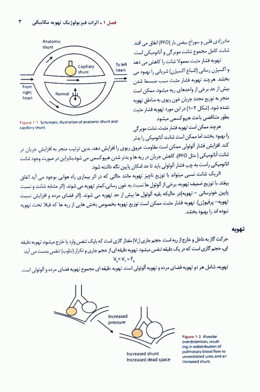 ضروریات تهویه مکانیکی دکتر مژگان مهاجری ایروانی