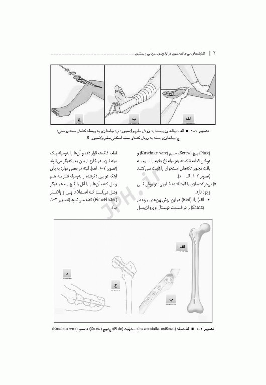 تکنیک‌های بی حرکت‌سازی در ارتوپدی سرپایی و بستری همراه با DVD فیلم آموزشی