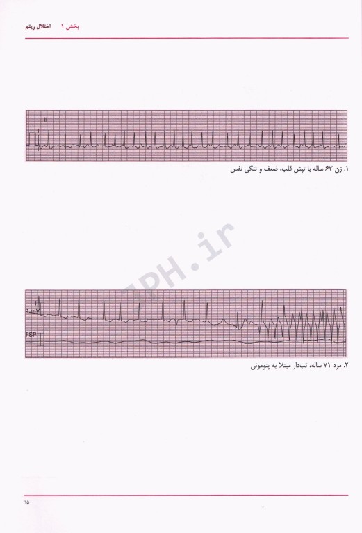 EKG های شایع 2 برای پزشکان