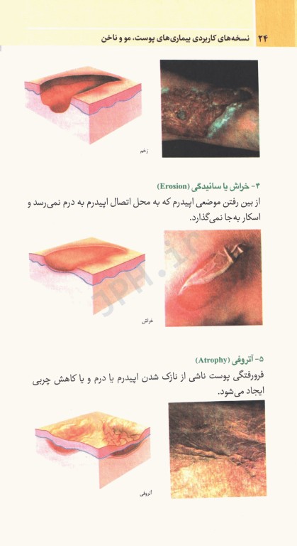 نسخه‌های کاربردی بیماری‌های پوست مو و ناخن