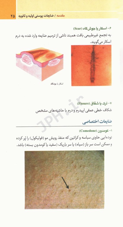 نسخه‌های کاربردی بیماری‌های پوست مو و ناخن