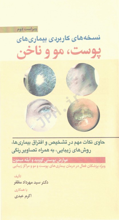 نسخه‌های کاربردی بیماری‌های پوست مو و ناخن