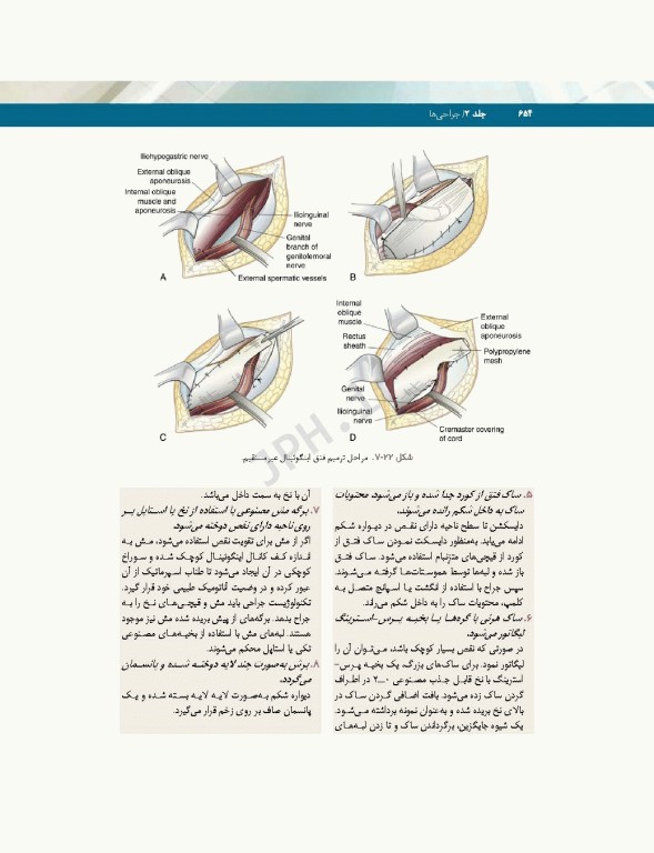 تکنولوژی جراحی فولر 2022 جلد2 جراحی‌ها