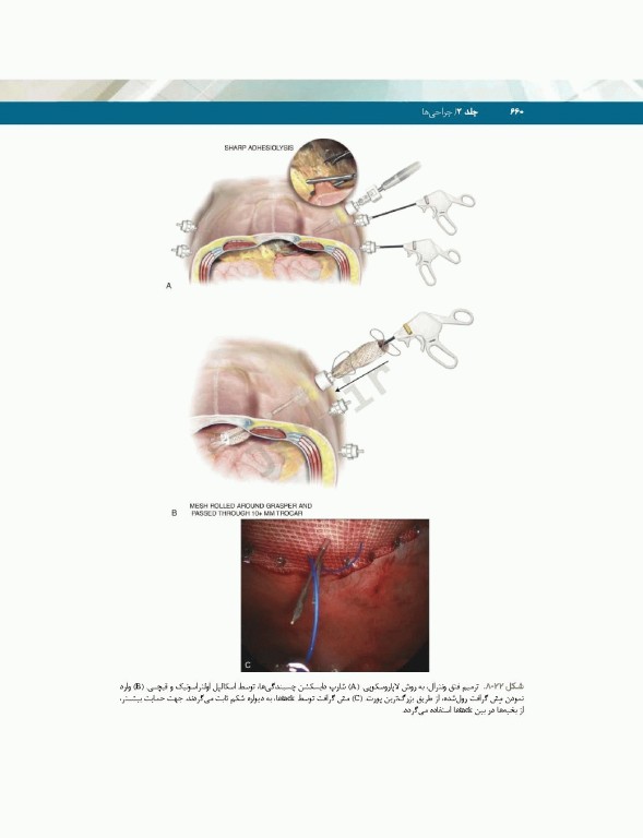 تکنولوژی جراحی فولر 2022 جلد2 جراحی‌ها