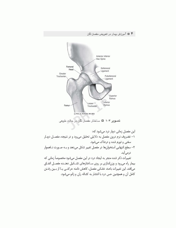 آموزش به بیمار و خانواده تعویض مفصل لگن