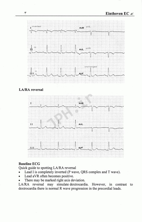 برترین و تخصصی‌ترین نکات آموزش نوار قلب ECG جلد1 مقدماتی