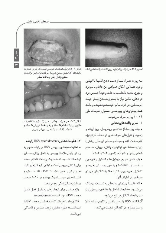 خلاصه کتاب Book Brief بیماری‌های دهان برکت 2021