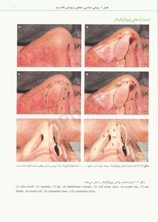اطلس راینوپلاستی دنیل 2018