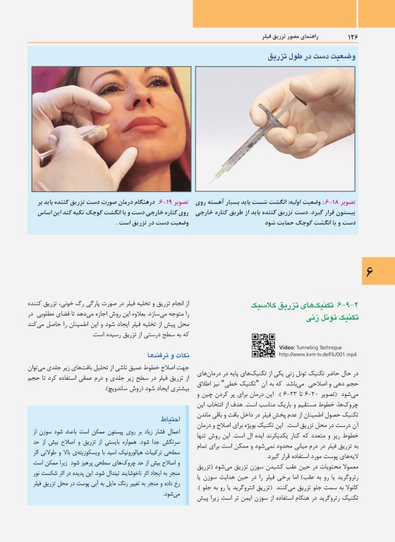 راهنمای مصور تزریق فیلر دکتر داوود رمزی