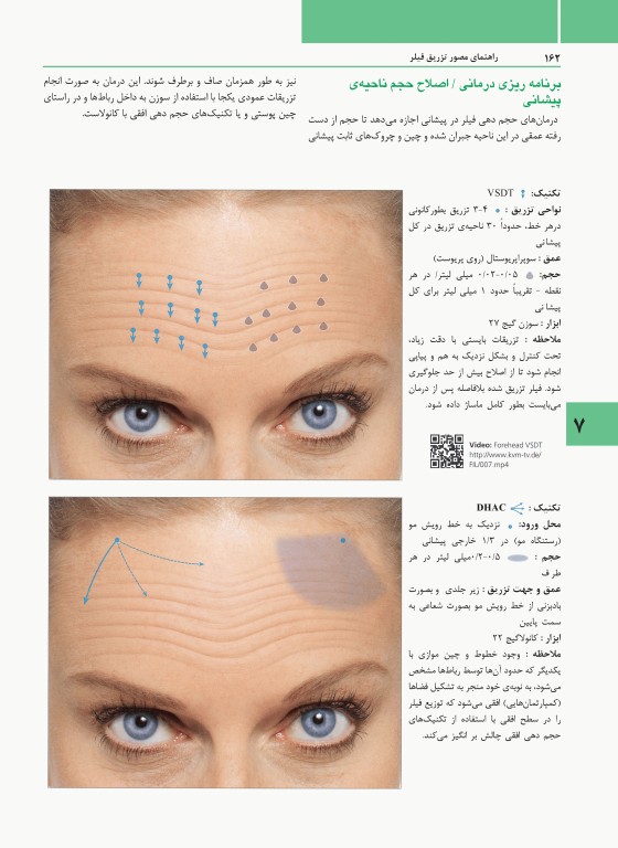 راهنمای مصور تزریق فیلر دکتر داوود رمزی