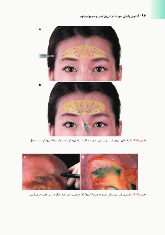 راهنمای کاربردی آناتومی بالینی صورت در تزریق فیلر و سم بوتولینوم دکتر رمزی