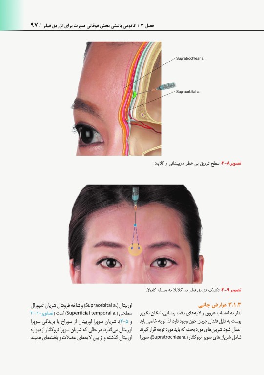 راهنمای کاربردی آناتومی بالینی صورت در تزریق فیلر و سم بوتولینوم دکتر رمزی