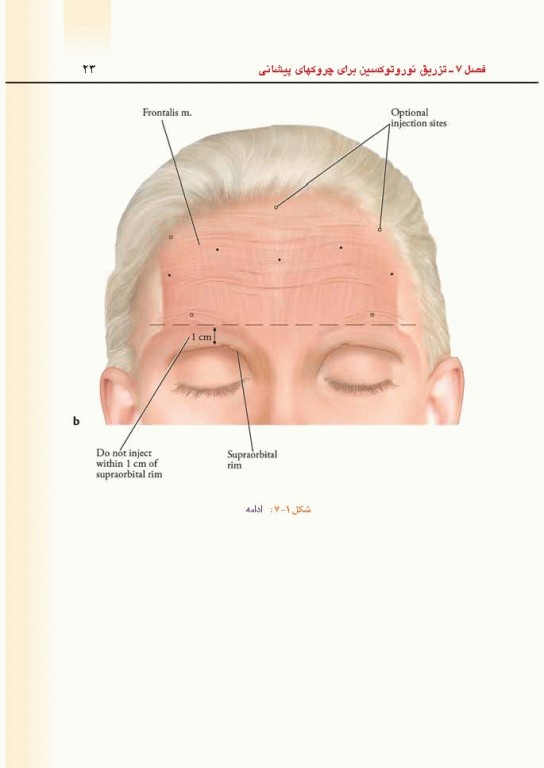 راهنمای کاربردی تکنیک‌های تزریق زیبایی دکتر رمزی