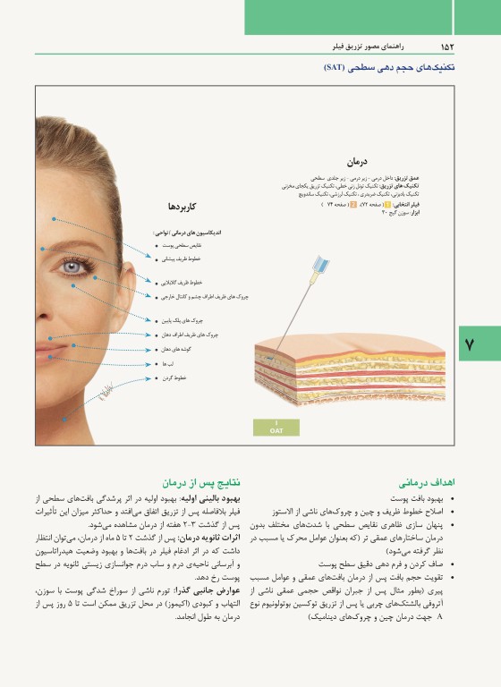 راهنمای مصور تزریق فیلر دکتر داوود رمزی