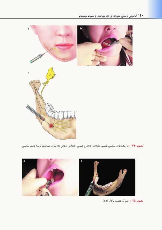 راهنمای کاربردی آناتومی بالینی صورت در تزریق فیلر و سم بوتولینوم دکتر رمزی
