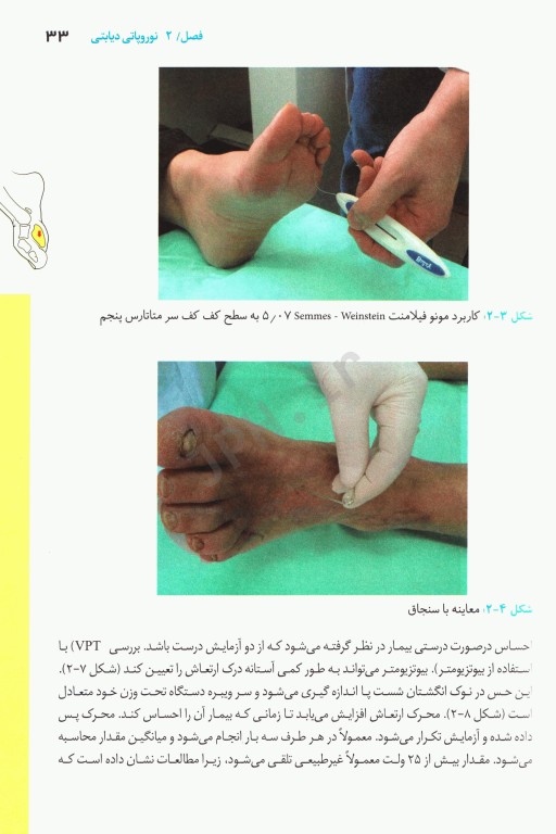 اطلس پای دیابتی