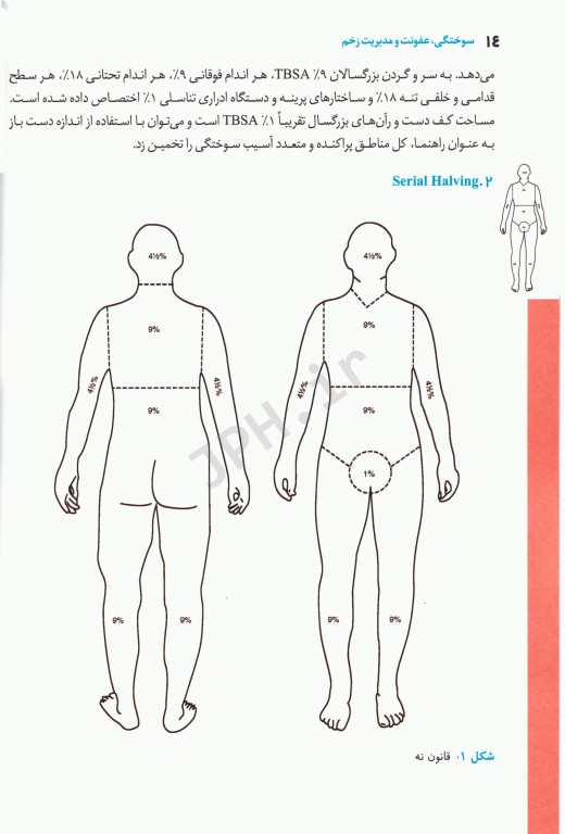 تکنیک‌های بالینی یافته‌ها و تحقیقات جدیدی در زخم‌های سوختگی عفونت و مدیریت زخم