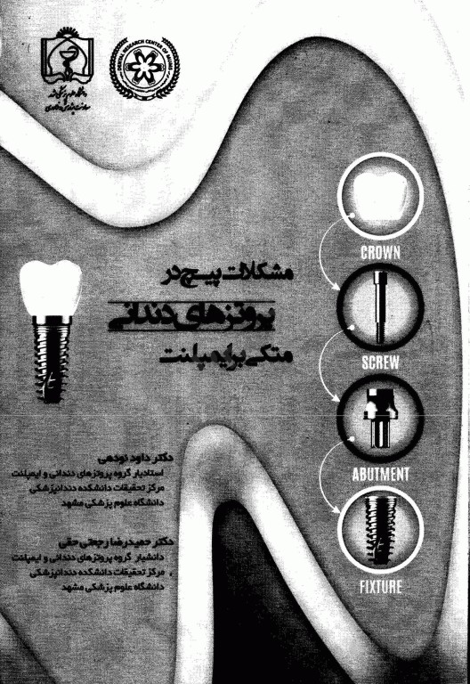 مشکلات پیچ در پروتزهای دندانی متکی بر ایمپلنت