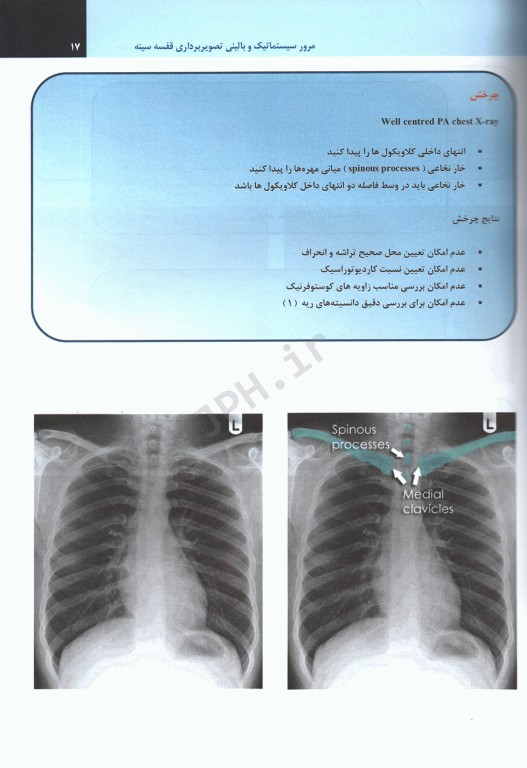 مرور سیستماتیک و بالینی تصویربرداری قفسه سینه