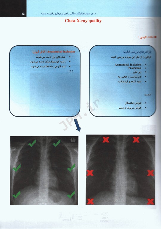 مرور سیستماتیک و بالینی تصویربرداری قفسه سینه
