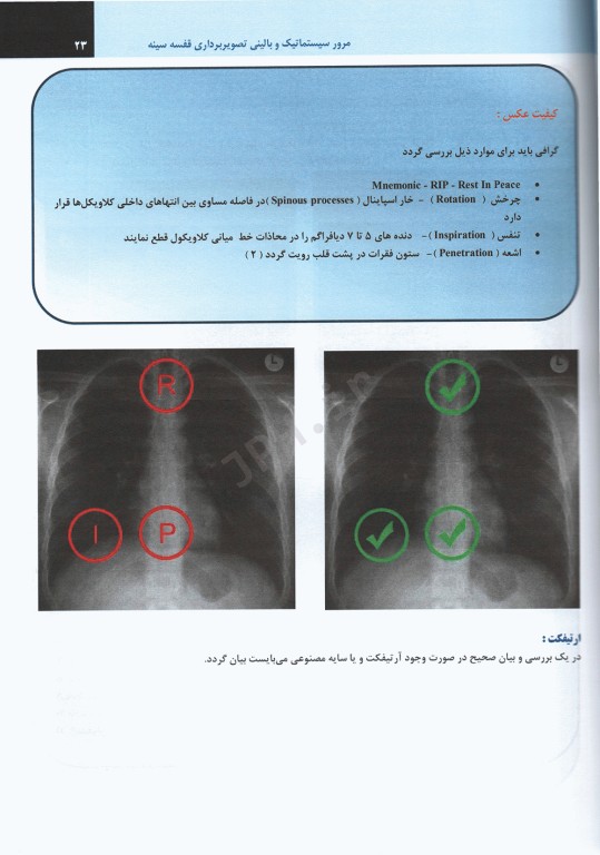 مرور سیستماتیک و بالینی تصویربرداری قفسه سینه