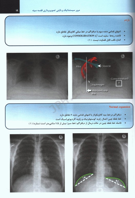 مرور سیستماتیک و بالینی تصویربرداری قفسه سینه