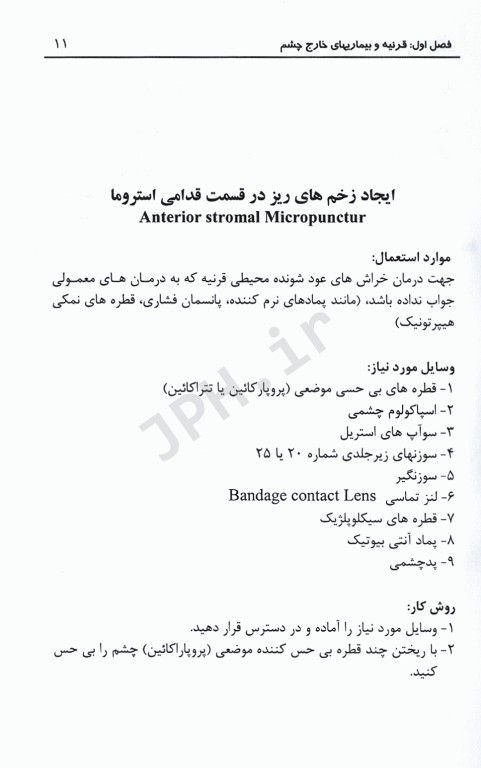 شرح گام به گام جراحی‌های چشم در مطب