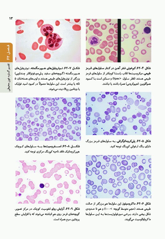 اصول طب داخلی هاریسون 2022 هماتولوژی