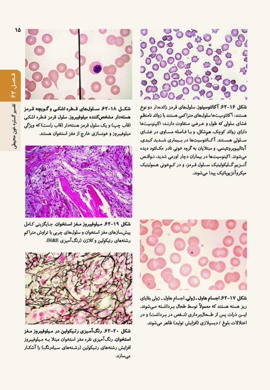 اصول طب داخلی هاریسون 2022 هماتولوژی