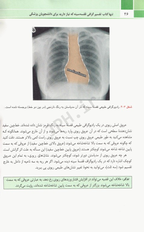 تنها کتاب تفسیر رادیوگرافی قفسه سینه که نیاز دارید