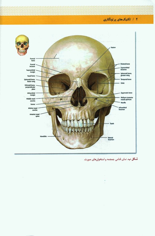 تکنیک‌های پرتونگاری آزمون‌های رادیولوژی جمجمه استخوان‌های صورت و سینوسهای پارانازال مریل